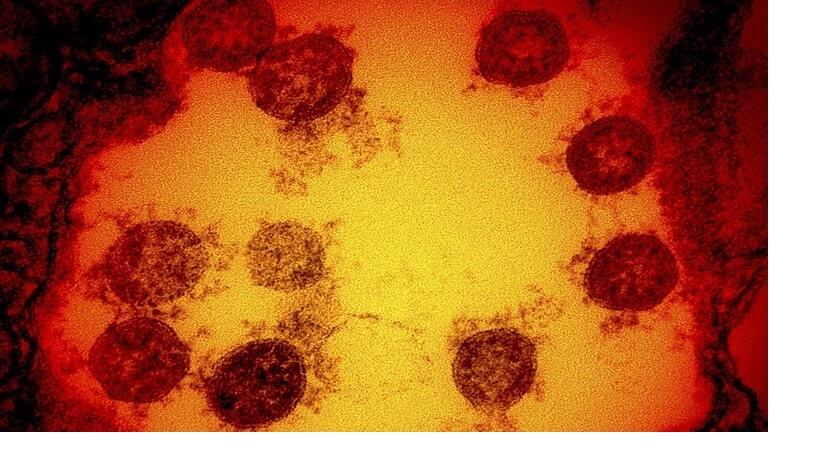 تسجيل ثلاث حالات جديدة بفيروس كورونا و4حالات تعافي بالشمالية